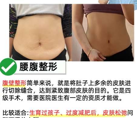 南昌二附易阳艳怎么样？医生资质点评！双眼皮/吸脂技术点评插图4