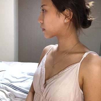徐占锋隆胸怎么样？医生详细介绍、技术优势、收费价格表公开插图2