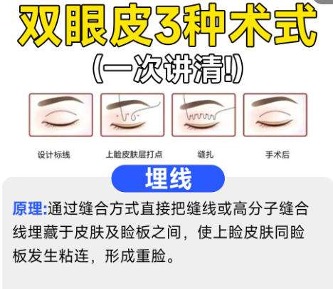 褚燕军预约需要多长时间？附医生详细介绍及客户点评插图4