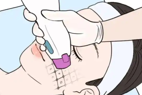 北京八大处热玛吉多少钱?面部、眼周、颈部分别收费多少一文看懂插图 北京八大处热玛吉多少钱?面部、眼周、颈部分别收费多少一文看懂插图