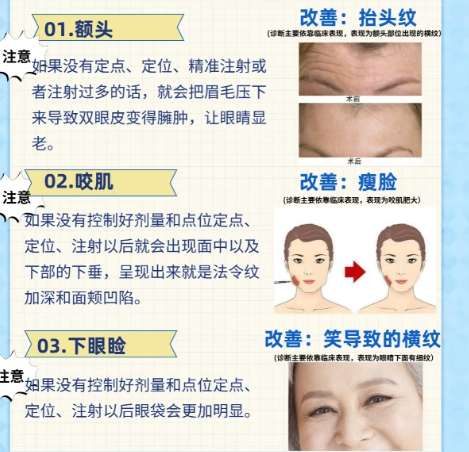 太原三甲整形医院去皱多少钱?2026收费标准更新!插图 太原三甲整形医院去皱多少钱?2026收费标准更新!插图