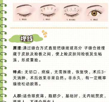 南宁帕拉美收费价格表2026最新发布!做双眼皮技术如何?插图4 南宁帕拉美收费价格表2026最新发布!做双眼皮技术如何?插图4