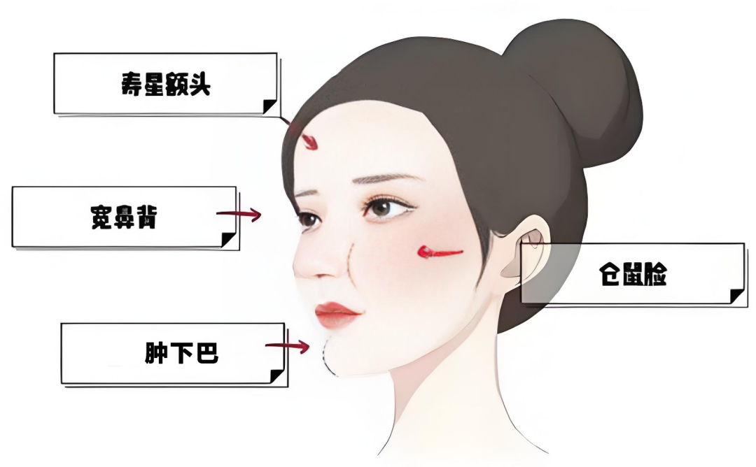 溶解酶多久能完全代谢掉?看这几点就知道插图1 溶解酶多久能完全代谢掉?看这几点就知道插图1