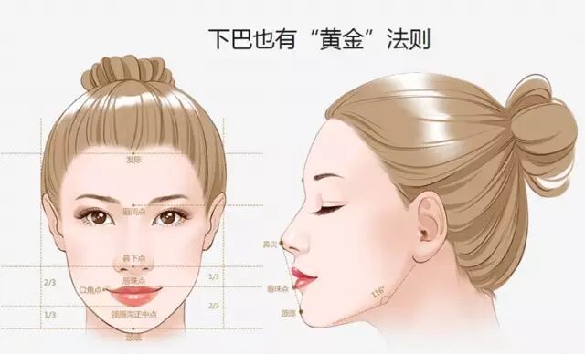 硅胶垫下巴手术步骤是怎样的？垫下巴手术后的九大护理要知道插图