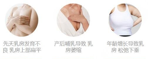 长沙自体脂肪隆胸多少钱？2026真实价格参考插图1