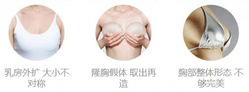 长沙自体脂肪隆胸多少钱？2026真实价格参考插图2