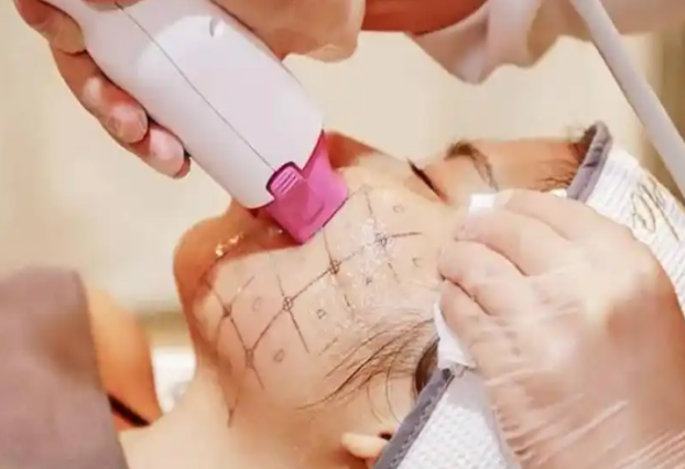 热玛吉做一次能维持多久 效果能撑一年吗？插图