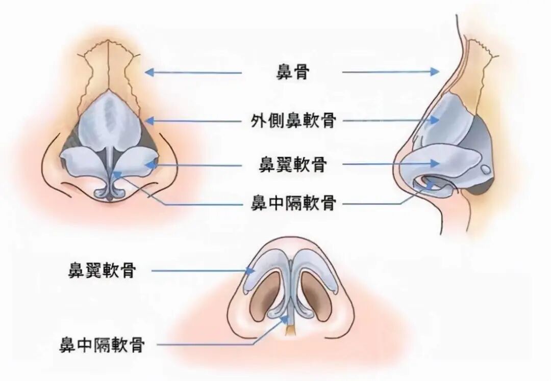 北京鼻部整形去哪里好?鼻部整形方法插图 北京鼻部整形去哪里好?鼻部整形方法插图