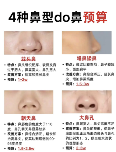上海八院隆鼻多少钱？2026最新价格表+3个真实案例，避坑指南藏这了插图