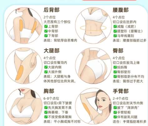 湖南省人民医院李高峰怎么样？做隆胸好不好？优势点评插图4