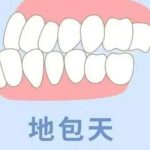 东莞地包天治疗要多少钱？1万元起，性价比高的医院详情分享