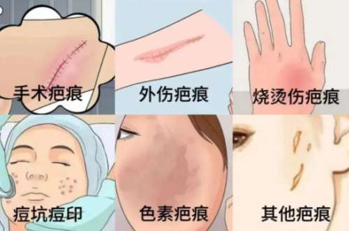 郭晓波医美医生技术咋样？祛疤效果好吗？经典案例展示插图1