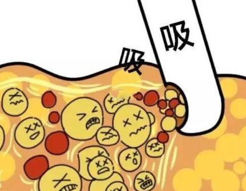 北京禾美嘉医疗美容医生口碑怎么样?吸脂专家技术精湛、评价好插图2 北京禾美嘉医疗美容医生口碑怎么样?吸脂专家技术精湛、评价好插图2