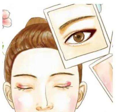 北京韩勋双眼皮修复怎么样插图2 北京韩勋双眼皮修复怎么样插图2