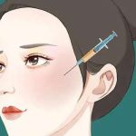 北京协和整形外科做脂肪填充大概需要多少钱？1.2万元起，医生详情分析