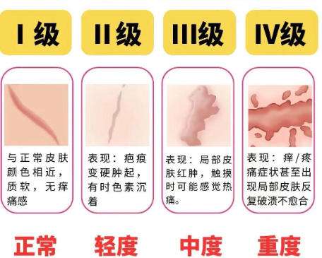 吕开阳医生最厉害三个方面公布！祛疤、吸脂等技术剖析！插图1