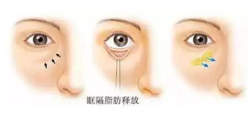 成都刘豪做手术咋样？擅长时尚大双风格，口碑较好插图1
