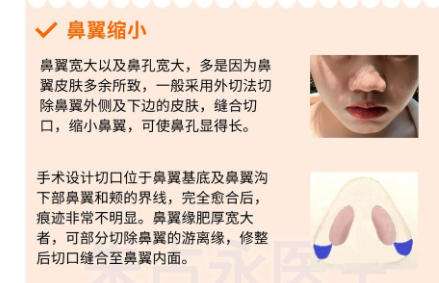 王晋煌医生口碑怎样？附人气项目推荐及案例反馈插图2