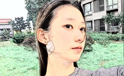 西安艾薇美肤质改善高赞医生分享，医生选择攻略插图1