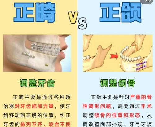 李逸松医生怎么预约？附真实术后口碑供您参考！速速收藏插图3