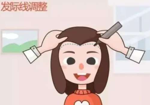 北京安贞医院植发价格多少?低至8k起!价格详情、医生、案例分析!插图3 北京安贞医院植发价格多少?低至8k起!价格详情、医生、案例分析!插图3