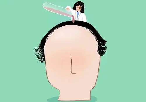 上海现在植头发一般多少钱?1-8万元,价格明细、医生等重点剖析插图1 上海现在植头发一般多少钱?1-8万元,价格明细、医生等重点剖析插图1