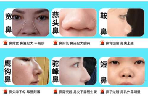 王晋煌医生口碑怎样？附人气项目推荐及案例反馈插图4
