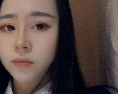 戴传昌做鼻子案例，术后收获脸部立体感插图3