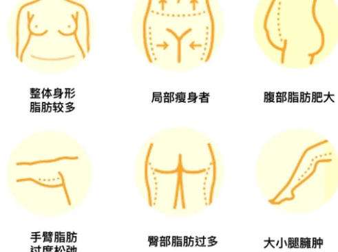 武凤莲做双眼皮怎么样好看吗？医生简介双眼皮案例精选插图3