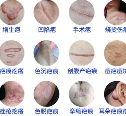 付记乐医生最厉害三个地方盘点！去疤痕技术优势剖析！含2026价格插图4