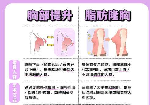 金石峰双眼皮效果图片揭示！含医生详细介绍及真实口碑点评插图3