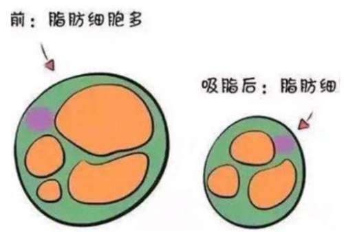 成铤吸脂怎么样?多少钱?医生口碑评价、个人资料分析插图1
