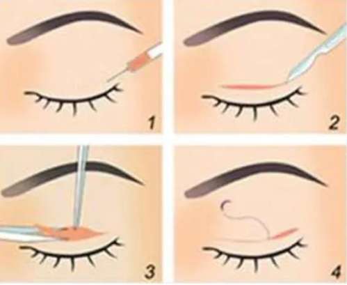 上海眼修复医生柴云怎么样插图1 上海眼修复医生柴云怎么样插图1