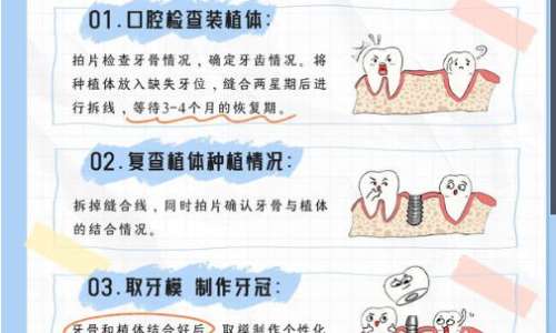 在桂林种植一颗牙齿要多少钱？价格在3k到1w不等含人气医院推荐！插图1