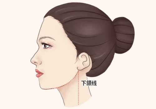 2026西安中心医院磨骨手术价格公开！26000元-70000元不等！插图3