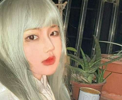 苏北医院陈啸双眼皮案例，让心灵的窗户更美插图3