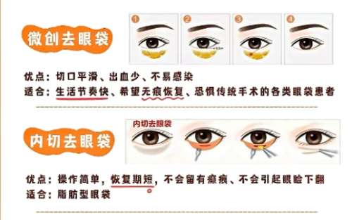 成都华西医院做眼袋手术多少钱？人气医生团队相关简介！插图
