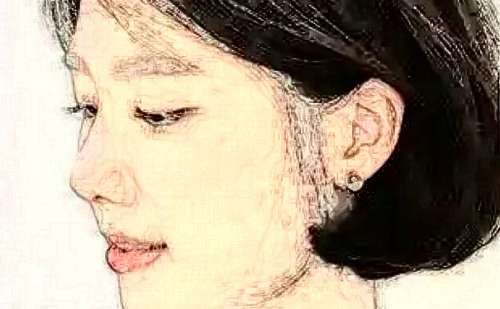 八大处整形医院李川激光美容祛斑案例欣赏|技术特色怎么样?费用低至5000元起;插图1 八大处整形医院李川激光美容祛斑案例欣赏|技术特色怎么样?费用低至5000元起;插图1
