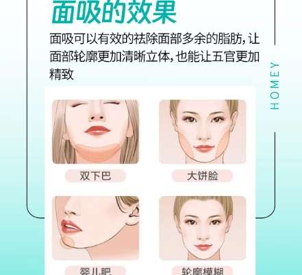 成都面部吸脂价格大概多少钱?2026收费明细参考!插图4 成都面部吸脂价格大概多少钱?2026收费明细参考!插图4