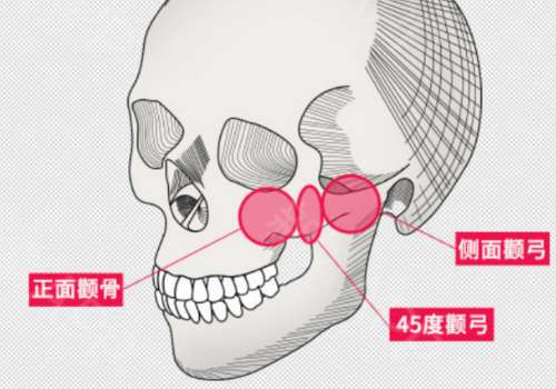 北京八大处正颌手术价格是多少？4w元起，2026全新新反馈来了！插图3