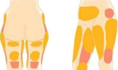 重庆王科做手术咋样？技术稳定性价比高，修复手术经验丰富插图1