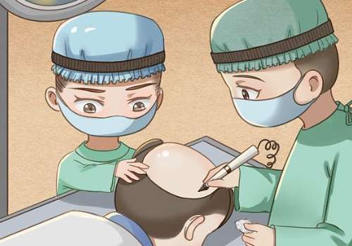 东台中医院植发多少钱?8000元起,价格明细、植发步骤与避坑指南分享插图3 东台中医院植发多少钱?8000元起,价格明细、植发步骤与避坑指南分享插图3