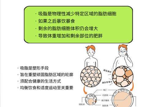 田雅光双眼皮属于什么档次？实力典评技术优势术后案例一览插图3