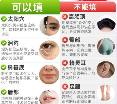 北京八大处郭鑫怎么挂号？抗衰项目、脂肪填重项目剖析！含挂号攻略插图2