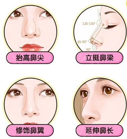 北京柏丽医疗美容医生介绍，吸脂隆鼻实力专家参考插图2
