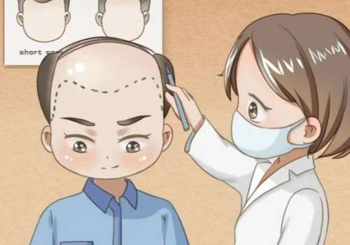 广西民族医院植发多少钱?1w起!价格明细_面诊指南_项目科普插图 广西民族医院植发多少钱?1w起!价格明细_面诊指南_项目科普插图