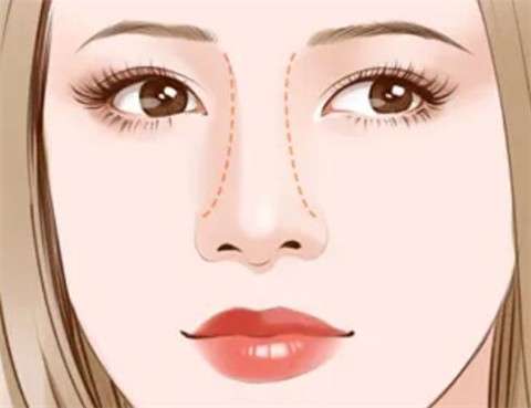 重庆李任隆鼻怎么样？医生口碑评价都比较好！最新收费价钱曝光插图1