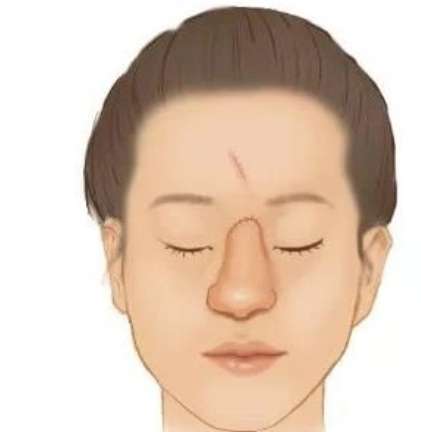 武汉中南医院整形科费用高吗?坐诊医生哪位技术好?特色项目推荐插图4 武汉中南医院整形科费用高吗?坐诊医生哪位技术好?特色项目推荐插图4