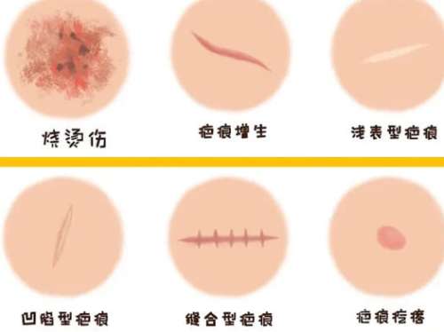 吕开阳医生最厉害三个方面公布！祛疤、吸脂等技术剖析！插图3