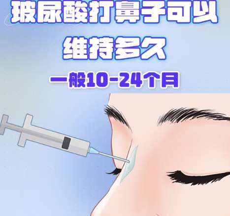 成都娇点注射隆鼻多少钱?2026收费标准更新!插图3 成都娇点注射隆鼻多少钱?2026收费标准更新!插图3